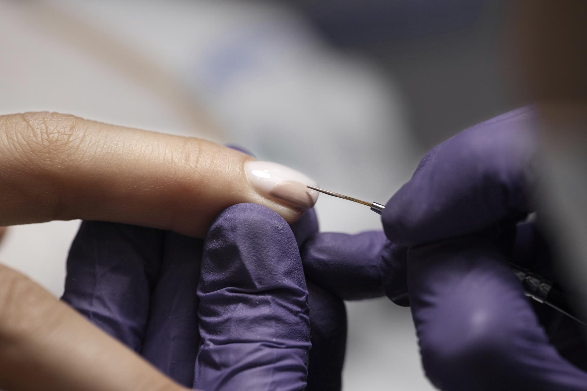 Viral Nail Conditions